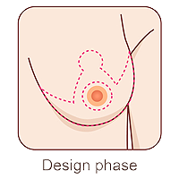 breast reduction design phase